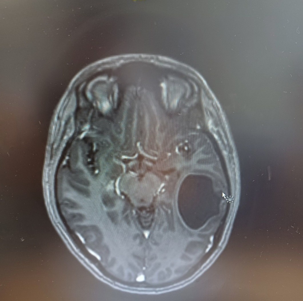 The MRI that changed everything